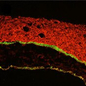 IF of osteosarcoma cells 14 hours post-seeding on chick chorioallantoic membrane stained with DSHB antibody 7D6 against E-cadherin (green). Image credit: PMID 32591581, Fig. 4A